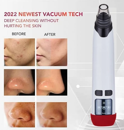 جهاز تنظيف البشرة