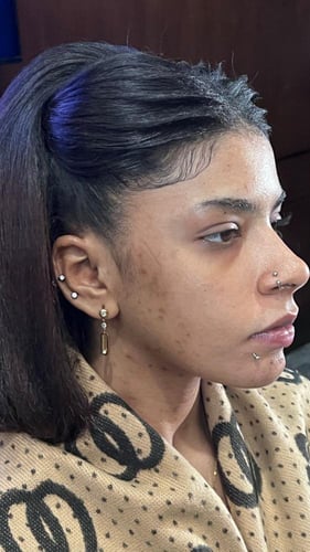 مصحح الهالات والتصبغات الغامقة