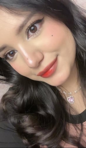 تنت شفاه درجه 2