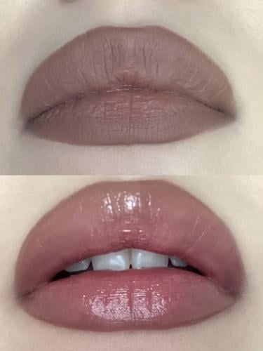 محدد شفاه درجه 3