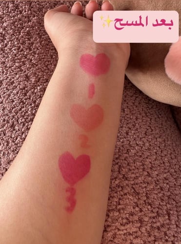 تنت شفاه درجه 2