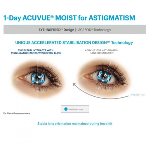 عدسات اكيوفيو مويست للاستجماتيزم (انحراف القرنية)