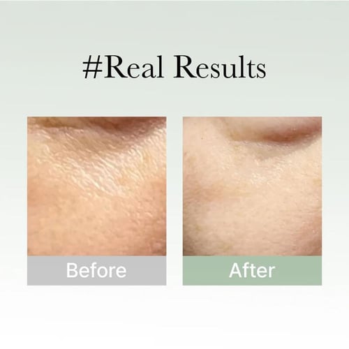 سيروم مضاد التجاعيد وإصلاح عيوب البشرة 50 جرام من...