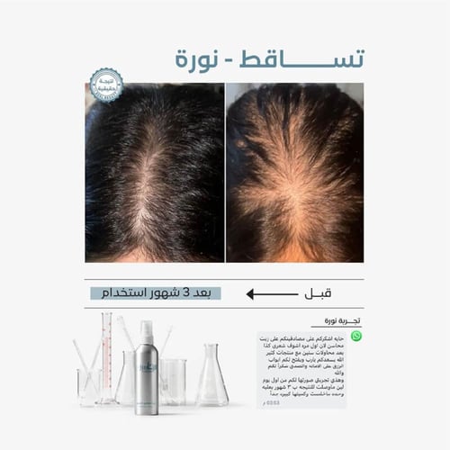 زيت لتكثيف ونمو الشعر وزيادة طوله 200 مل من محاسن