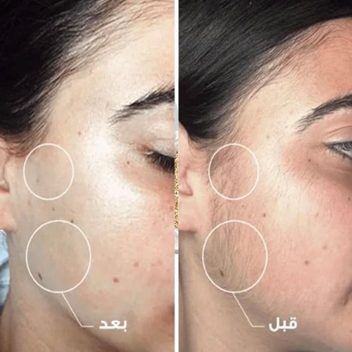 جهاز ازالة شعر الوجه والجسم من جيفما