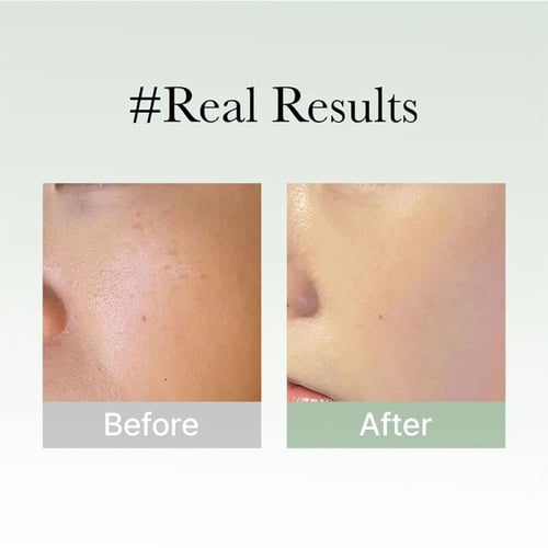 سيروم مضاد التجاعيد وإصلاح عيوب البشرة 50 جرام من...