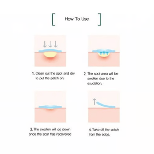 سوم باي مي لصقات حب الشباب 18 لصقه