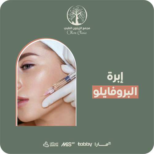 ابرة البروفايلو