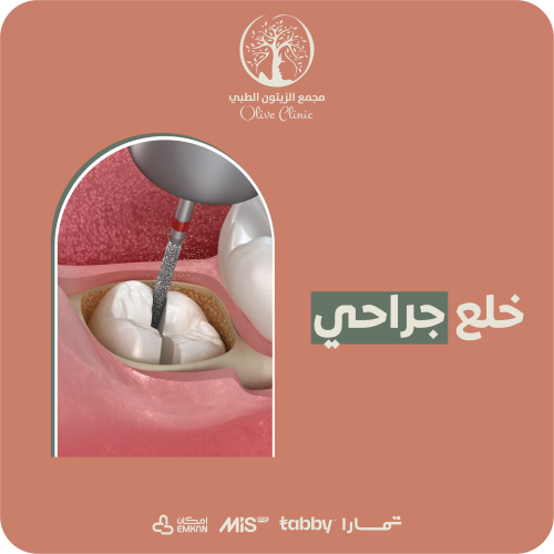 خلع جراحي يبدأ من