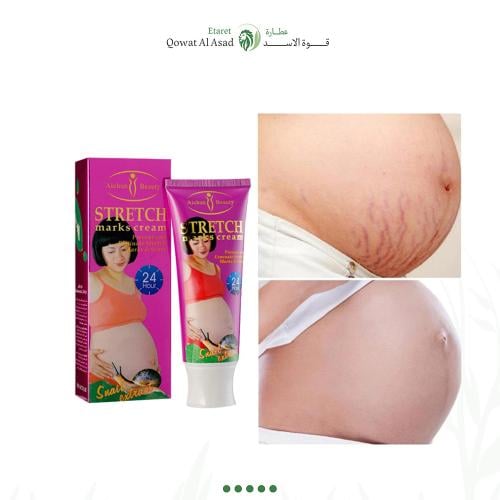 كريم إزالة علامات التمدد من Aichun Beauty للحوامل...