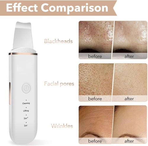 ارابيست جهاز تنظيف البشرة لتنظيف المسام، ادوات لطي...