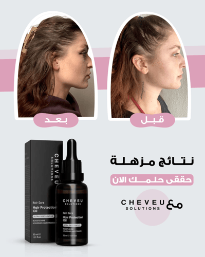 مجموعة شيـــفو لتغذية وحماية الشعر بزيت إكليل الجب...