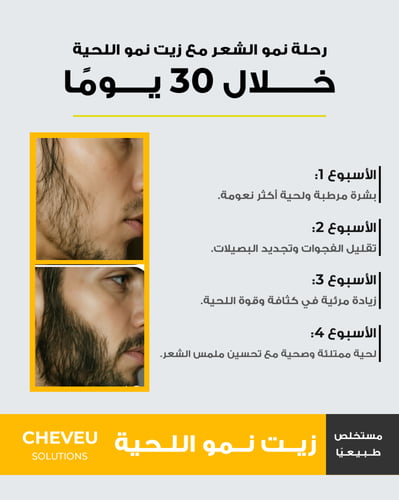 زيت نمو اللحية مع دينسي بيرد™، إكليل الجبل، والزيو...