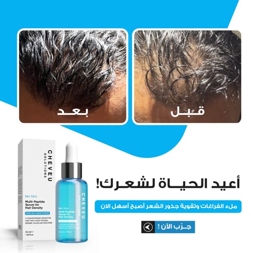 شيفو كومبلكس™ مجموعة نمو الشعر للرجال | إمداد لمدة...