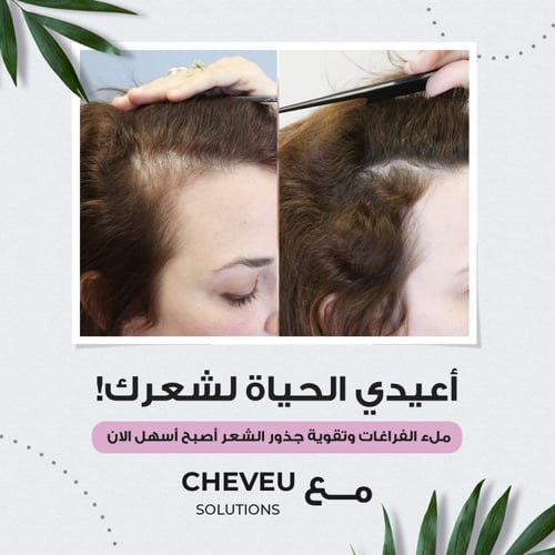 مجموعة شيـــفو لنمو وكثافة الشعر للنساء مع AnaGain...