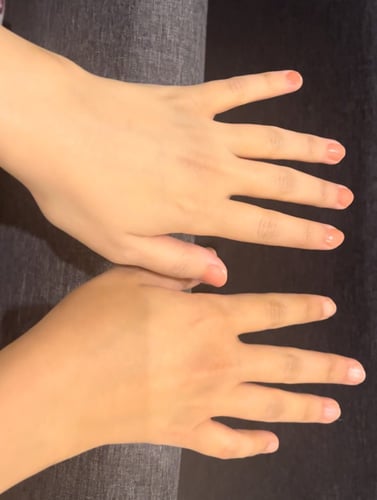 كريم التبييض الفوري