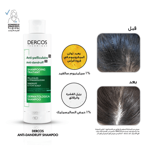 فيشى، ديركوس شامبو ضد القشرة للشعر الجاف 200 مل