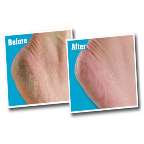 اوكيفس - كريم القدمين هيلثي فيت 76 جم