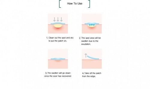 لصقات المعجزة لإزالة حب الشباب من سوم باي مي - 18...