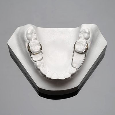 122 جهاز حافظ مسافة Space maintainer