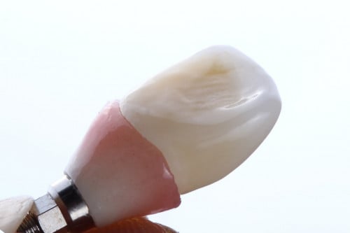 259 هيكل زركون للزراعة مع بناء خزف وخزف لثة Zircon...