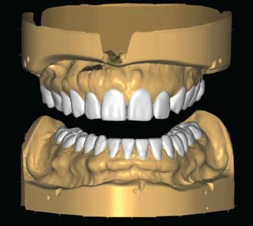 295 ابتسامة رقمية على نموذج Digital Smile design o...