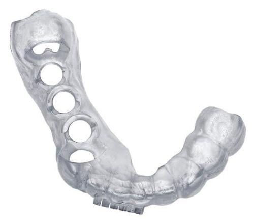 190. دليل جراحي للزرعات تصميم مع أشعة cbct وطباعة...