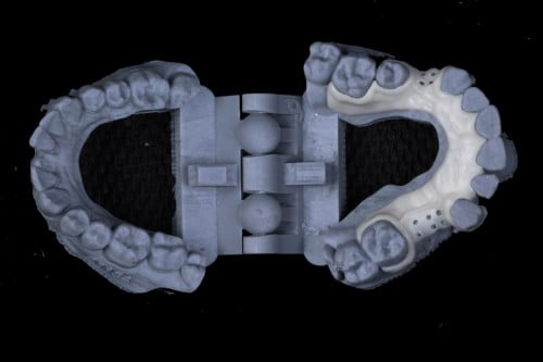 247 طقم جزئي علوي أو سفلي مرن كاد كام Cad/Cam flex...