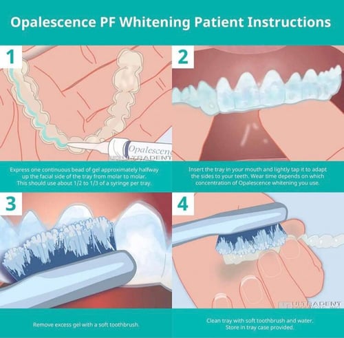 Opalescence whitening kit home -تبييض منزلي نعناع...