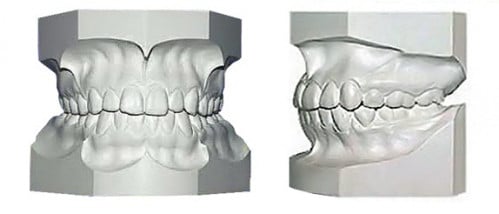 STUDY MODELS CAST