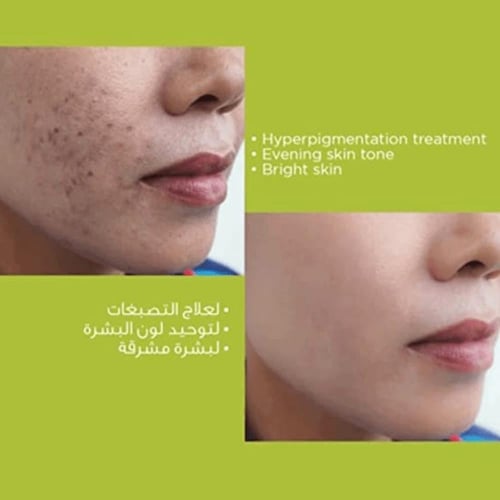 مقشر الفا بلس 4 في 1 لتفتيح البشرة من أفالون فارما...