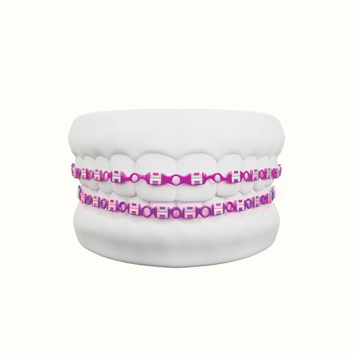 تقويم زينه فكين متصل بغراء