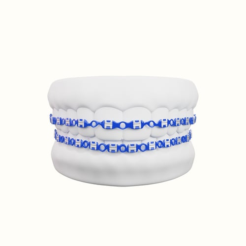 تقويم زينه فكين متصل بغراء