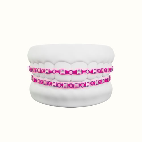 تقويم زينه فكين متصل بغراء