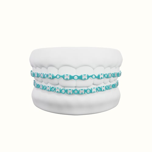 تقويم زينه فكين متصل بغراء