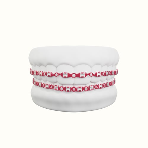 تقويم زينه فكين متصل بغراء