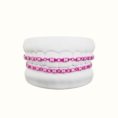 تقويم زينه فكين متصل بغراء