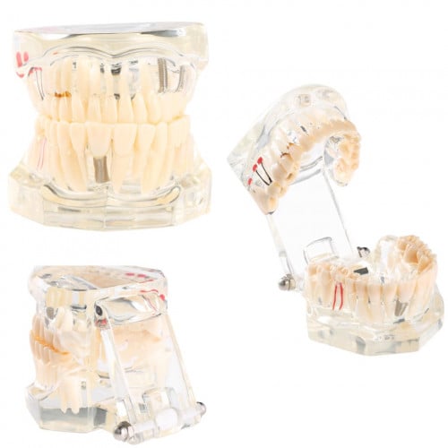 نموذج فك اسنان