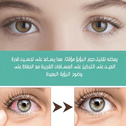 بكرة تعزيز الرؤية لتعزيز الوضوح البصري