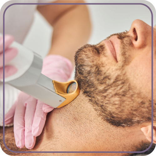 Mini body laser session for men (chin and neck def...