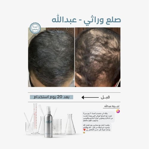 زيت محاسن الشعر