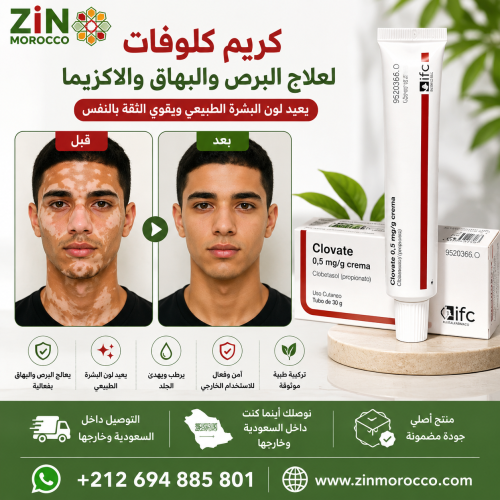 كريم كلوفات لعلاج البرص والبهاق والاكزينا
