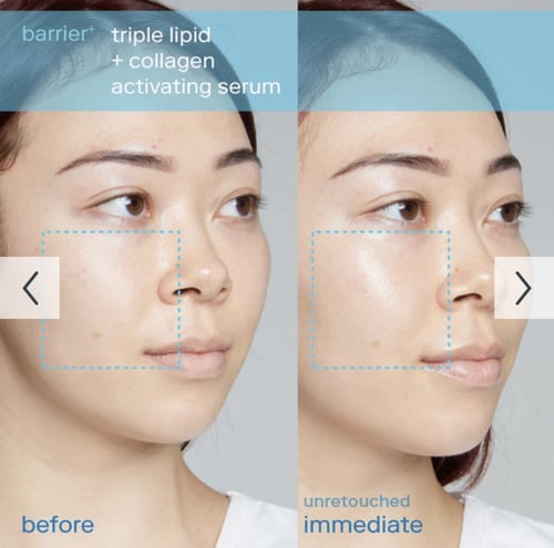 SkinFix - barrier+ Triple Lipid + Collagen Activat...