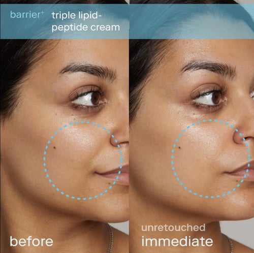 Skinfix Barrier+ Triple Lipid-Peptide Refillable F...