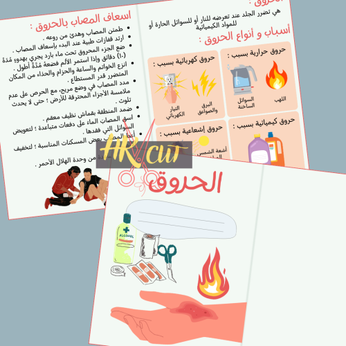الحروق - خامس ابتدائي ف 2
