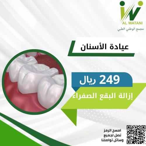 إزالة البقع الصفراء