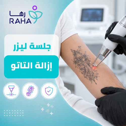 Laser tattoo removal session
