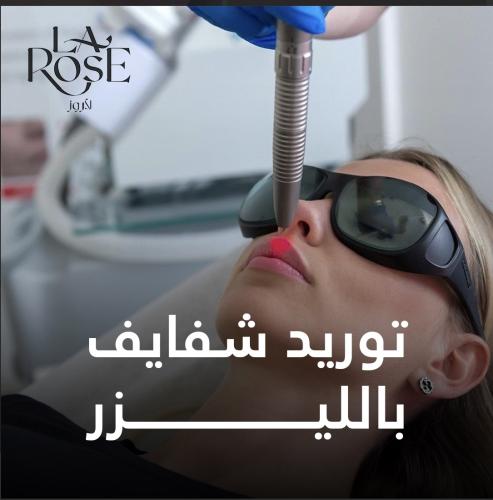 Lip laser supply session