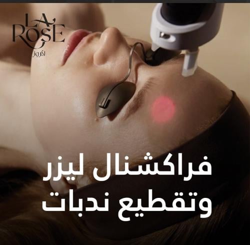Fractional session + scar removal