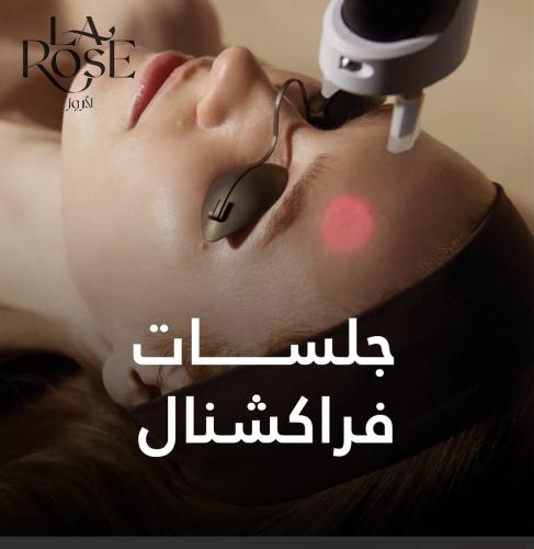 Fractional facial session
